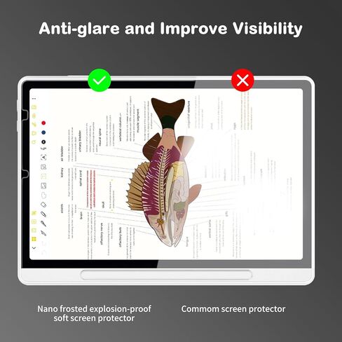 واقي شاشة مضاد للتوهج لجهاز XPPen Magic Note Pad Tablet مقاس 10.95 بوصة (2025) | مضاد لبصمات الأصابع | مقاوم للخدش | ملمس الورق | فيلم ناعم نانو غير لامع من PET | عبوتان | (غير لامع) in Kuwait