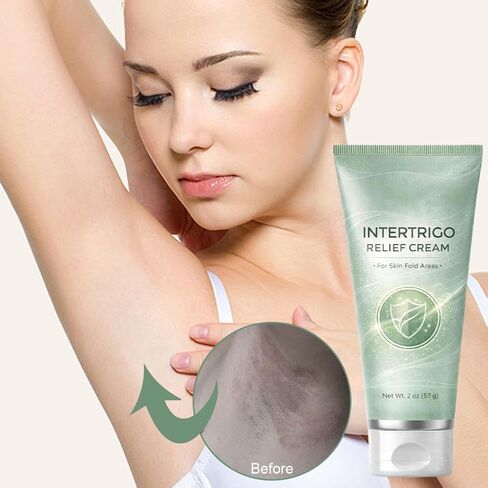 كريم Wmool Intertrigo - كريم للعناية بالبشرة ودعم الاحتكاك مع أكسيد الزنك وحمض Undecylenic - يساعد على تهدئة البشرة المتهيجة وتقليل الرطوبة والاحتكاك - تركيبة غير الستيرويد in Kuwait