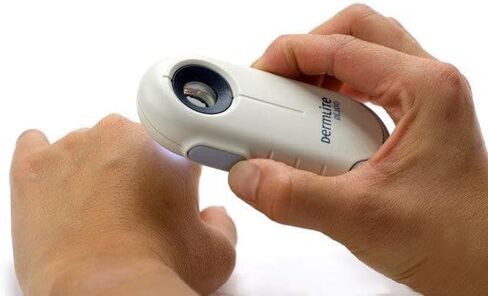 DermLite DL100 منظار الجيب المستقطب 3Gen Dermascope in Kuwait