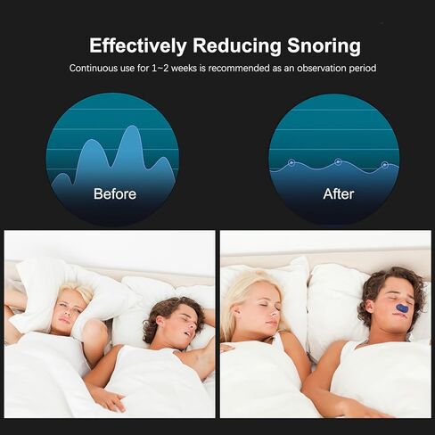 أجهزة مكافحة الشخير، حل فعال للشخير مع سرعة الرياح القابلة للتعديل، سدادات فتحات الأنف الموسعة لوقف الشخير من أجل نوم أفضل in Kuwait