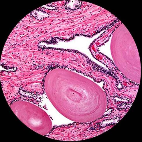 AmScope D120A-MS Dual-View Compound Monocular Microscope, WF10x and WF16x Objectives, 40X-1600X Magnification, Brightfield, 1.25 NA Abbe Condenser, Mechanical Stage in Saudi Arabia