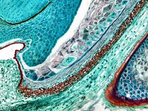 AmScope T650C-5M Digital Professional Trinocular Compound Microscope, 40X-2500x Magnification, WF10x and WF25x Widefield Eyepieces, Infinity Plan Objectives, Brightfield, Abbe Condenser, Double-Layer Mechanical Stage, Includes 5MP Camera with Reduction Le in Saudi Arabia