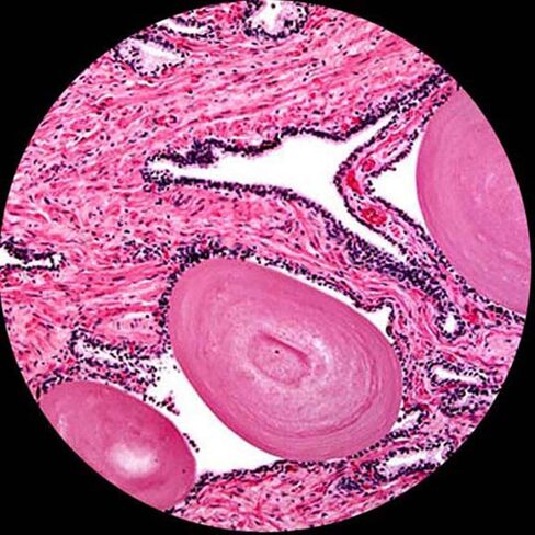AmScope U230B Digital Binocular Compound Microscope 40x-2000x with Built-in 3.0MP USB Digital Camera in Saudi Arabia