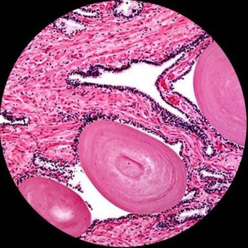 AmScope T690C-PL-8M Digital Trinocular Compound Microscope, 40X-2500X Magnification, WH10x and WH25x Super-Widefield Eyepieces, Infinity Plan Achromatic Objectives, Brightfield, Kohler Condenser, Double-Layer Mechanical Stage, Includes 8MP Camera with Red in Saudi Arabia
