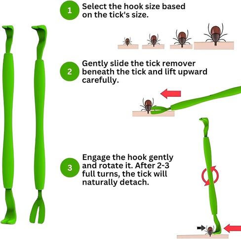 Tick Remover Tool - Safe & Easy Tick Remover for Humans and Pets - Effective Tick Remover for Cats and Dogs - Small to XL Tick Removal Tool for Dogs - Twist & Pull Tick Removal Kit (Set of 5) in Saudi Arabia