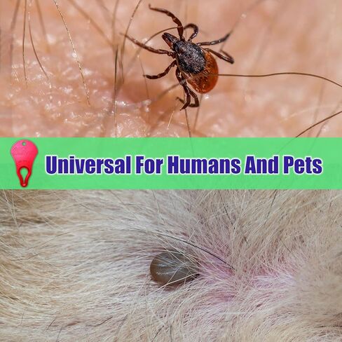 Tick Remover Tool 3 Pack – Portable Tick Key for Pets, Dogs, Animals, and Humans – Quick & Safe Tick Removal Tool – Essential Outdoor Camping Gear for Easy and Reliable Use in Saudi Arabia