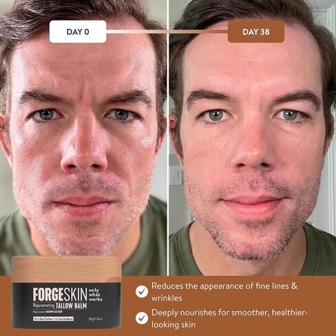 مرطب Forge Skin® Wrinkle Defense Beef Tallow Balm [يعتمد على الشحم] لترطيب الوجه - كريم مرطب مضاد للشيخوخة للبشرة - لوشن طبيعي للعناية ببشرة الوجه بالزيوت العطرية (1.76 أونصة) in Kuwait