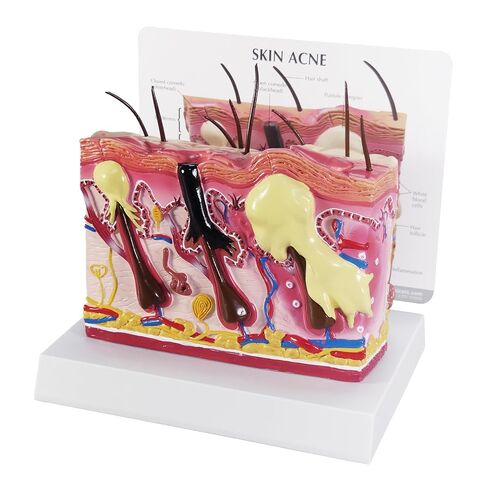 GPI Anatomicals - Aging Skin and Hair Loss Model, Replica Showing Aging and Normal Skin for Human Anatomy and Physiology Education, Anatomy Model for Doctor's Offices, Medical Learning Resources in Saudi Arabia