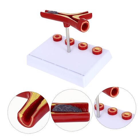 Cardiovascular Model 7-Inch Human Heart Blood Vessel Teaching Aid for Medical Education and Anatomy Study in Saudi Arabia