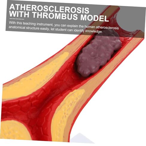 Cardiovascular Model 7-Inch Human Heart Blood Vessel Teaching Aid for Medical Education and Anatomy Study in Saudi Arabia