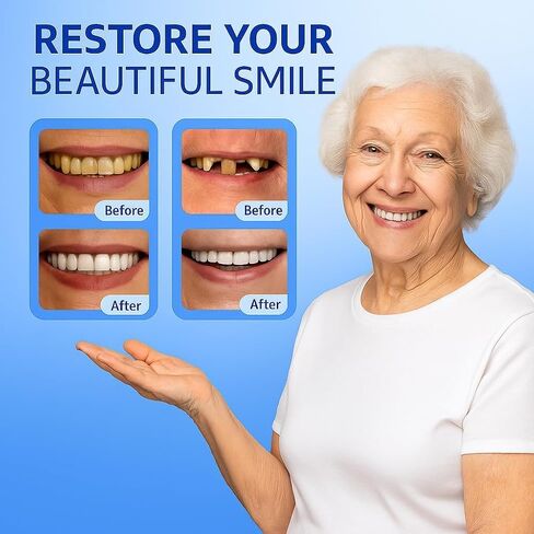 طقم أسنان يمكنك صنعه بنفسك لمظهر الابتسامة - مجموعة أسنان مزيفة ملائمة حسب الطلب مع ألواح علوية وسفلية، مادة راتنجية، سهلة الاستخدام في المنزل لتعزيز البصر in Kuwait