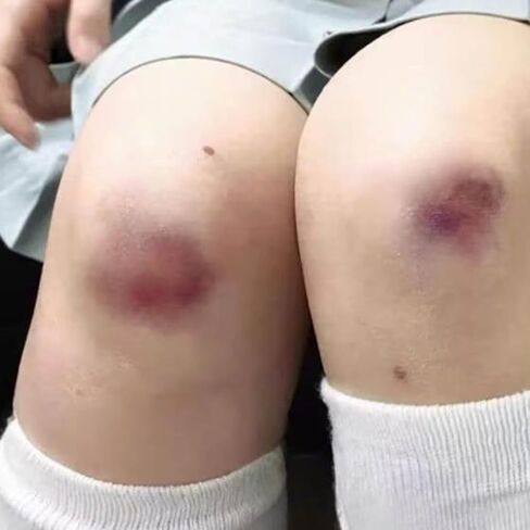 ملصقات جروح زي مؤقتة واقعية مقاس 17.78 سم للمقالب ومكياج الهالوين in Kuwait
