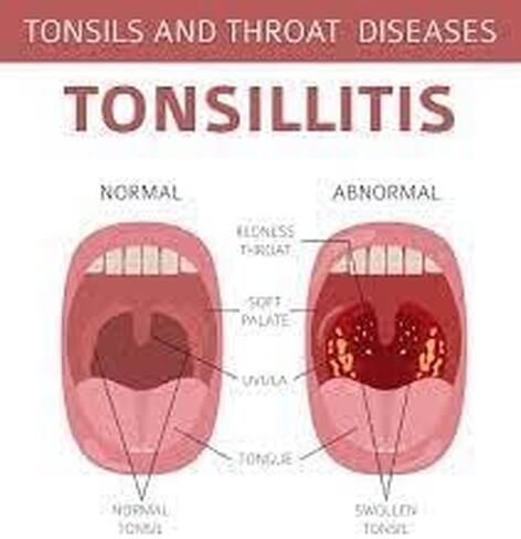 معينات تخفيف السعال من فلاناكس، 20 قرصًا لتخفيف الألم لتخفيف السعال والتهاب الحلق، قطرات السعال للبالغين مع مزيج من العسل والمنثول لإحساس رائع in Kuwait