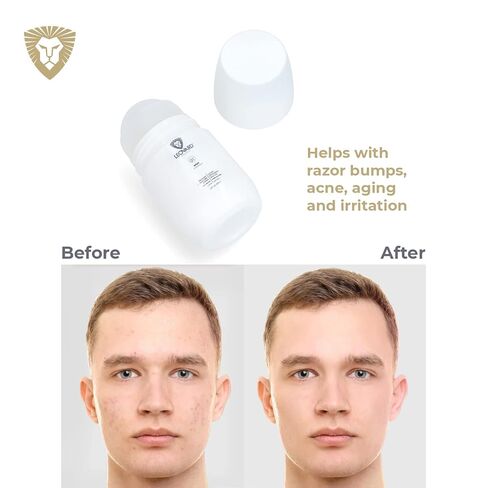 Leovard- Men & Women Razor Bump and Ingrown Hairs Serum - After Your Shave Solution Roll-On for Ingrown Hairs, Razor Bumps, Irritation, Blemishes and Discoloration in Saudi Arabia