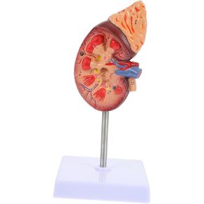 Amosfun Kidney Model Mannequin Kidney Dissection Model Anatomy Organs Model Human Organs Model Anatomical Model Biology Demonstration Model Biology Class Accessory PVC Human Body Dissector