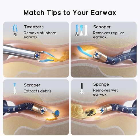 نصائح بديلة لكاميرا الأذن R1-12 قطعة من BEBIRD لتنظيف شمع الأذن الرطب/الجاف - مجموعة ملحقات ملاعق الأذن لـ Bebird R1 / T15 / R3 / W3 / X3 / M9 / D3Pro in Kuwait