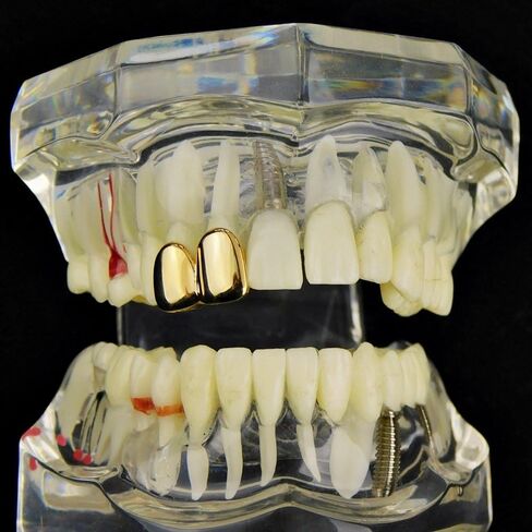 Double Tooth Grillz 14k Gold Plated Upper Top Right Side Canine Two Teeth Grills in Kuwait