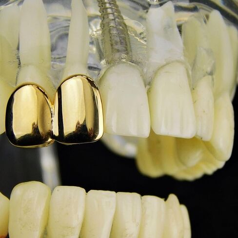 Double Tooth Grillz 14k Gold Plated Upper Top Right Side Canine Two Teeth Grills in Kuwait