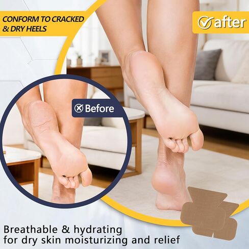 30 عبوة من 30 قطعة من رقع لاصقة لعلاج تشقق الكعب مقاس 11.43 سم × 10.16 سم in Kuwait