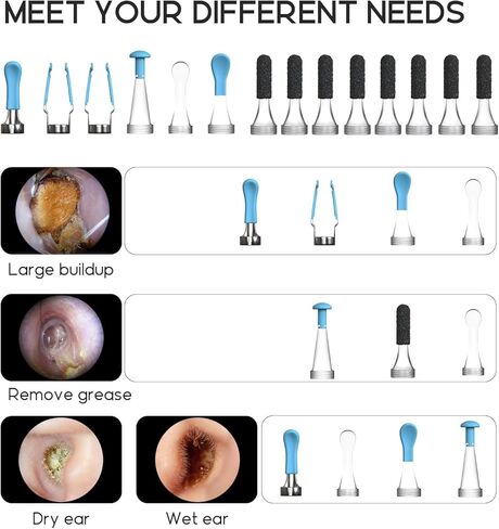 نصائح بديلة من Bebird - قاعدة كاميرا للأذن 2 في 1 وحقيبة تخزين لـ 9 نصائح لإزالة شمع الأذن وقابس أمان واحد لمنع الإدخال الزائد - متوافق مع R1/C3/R3/X1/X3/W3 ونماذج العلامات التجارية الأخرى in Kuwait