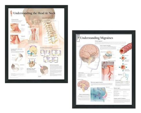 Set of 2 Framed Medical Posters Understanding The Head and Neck and Understanding Migraines 22"x28" Wall Diagrams Educational Informational Doctors Office Charts in Kuwait