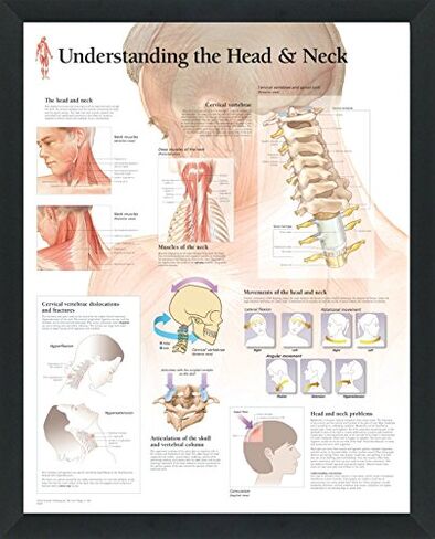 Set of 2 Framed Medical Posters Understanding The Head and Neck and Understanding Migraines 22"x28" Wall Diagrams Educational Informational Doctors Office Charts in Kuwait