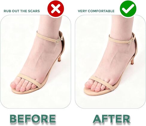 Gel Ball of Foot Cushions - Welnove 4 Pairs Metatarsal Pads Women Non-Slip Forefoot Cushion Shoes Inserts for Foot Pain Relief, Comfort, Shock Absorption & All-Day Wear in Sandals, High Heels, Flats in Saudi Arabia