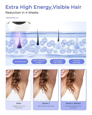 إزالة الشعر بالليزر للنساء والرجال، ملامسة بالتبريد الثلجي عند درجة حرارة 45 درجة فهرنهايت، بديل آمن وغير مؤلم تقريبًا لجهاز إزالة الشعر IPL في الصالونات، إزالة الشعر طويل الأمد من المنزل، باستخدام ماكينة الحلاقة والنظارات in Kuwait