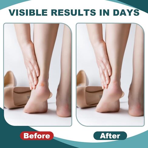 30 قطعة من ضمادات البثور الجل الغروانية المائية - وسادات بثور مقاومة للماء للقدمين والكعب وأصابع القدم - الوقاية والتعافي، الزفاف/الرياضة/أساسيات السفر in Kuwait