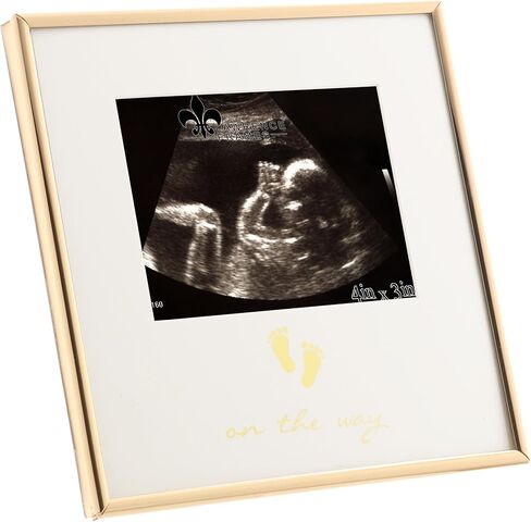 5x3 Sonogram - Ultrasound Gold Metla Picture Frame - On The Way Design in Saudi Arabia