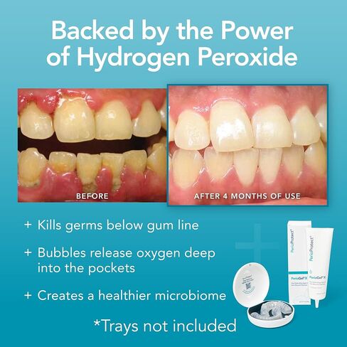 علاج اللثة للاسنان من بيريوجيلكس | يعزز تبييض الاسنان (3 اونصة) in Kuwait