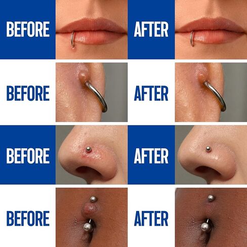 BodyJ4You Piercing Aftercare Saline Cleaning Solution - Nose Belly Ear Piercing Cleaner - Wound Wash Keloid Treatment Piercing Bump Removal - Sea Salt Aloe Rosemary - 0.33 Fl Oz (10ml) in Kuwait