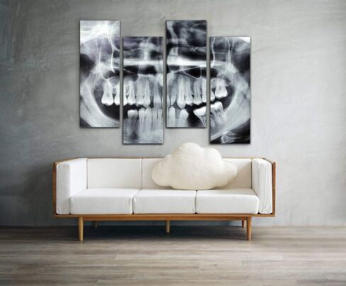 Wocatton dental model on white background dentals and pictures Wall Art Background Decor Pictures Print On Canvas Art Stretched and Framed Perfect Home Decoration in Saudi Arabia
