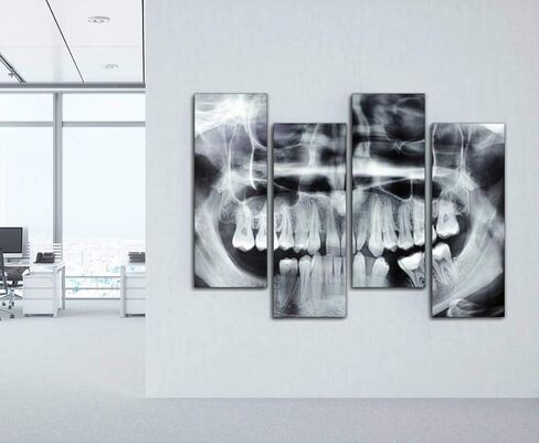 Wocatton dental model on white background dentals and pictures Wall Art Background Decor Pictures Print On Canvas Art Stretched and Framed Perfect Home Decoration in Saudi Arabia