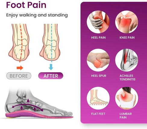 Welnove Women's High Impact Metatarsalgia Insoles - All-Purpose Orthotic Arch Support Inserts for Morton's Neuroma - Trim-to-Fit, Heel Spurs, Pain Relief, Podiatrist-Designed (Berry) -XL in Saudi Arabia