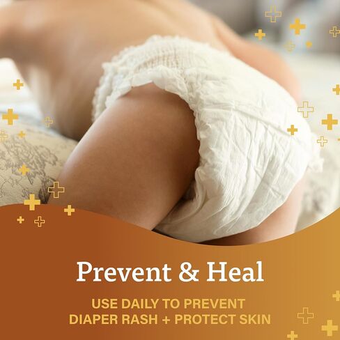 A+D Original Diaper Rash Skin Ointment, Baby Skin Protectant With Lanolin and Petrolatum, Helps Prevent Cracked Skin and Diaper Rash, 1.5 Ounce Tube, Packaging May Vary in Kuwait