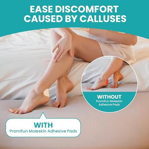 Moleskin Blister Tape Pads for Feet - Promifun 32ct of 4 Shapes Blisters Bandages for Foot, Toe, Heel,Finger - Mole Skin Patch Stickers for Shoe, Callus, Bunion Prevention & Recovery - Beige in Saudi Arabia