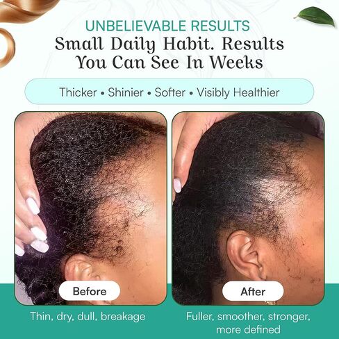 SPOILD Raw Batana Oil for Hair Growth - Sourced from Honduras, Dr. Sebi Approved, Unrefined & 100% Organic - Prevents Hair Loss, Strengthens Hair 2oz in Kuwait