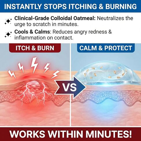 كريمة علاج التهاب البلاطانية ، تخفيف التهاب البلاث ، المكونات الطبيعية العضوية ، الجلد المهدئ ، تخفيف الحكة ، الجفاف ، الاحمرار ، التهيج والغضب - 3.52 أوقية in Kuwait