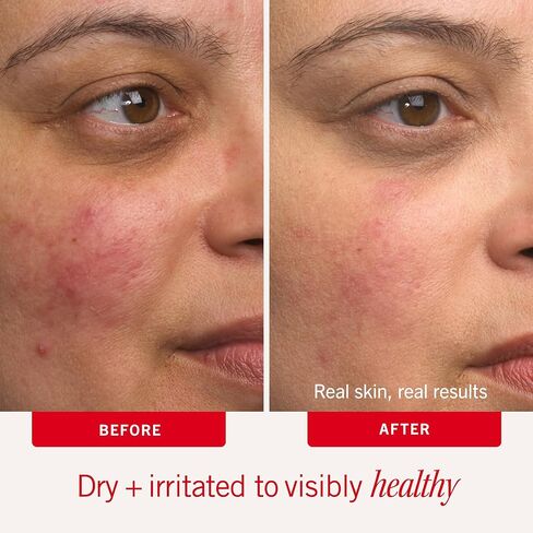 First Aid Beauty - Ultra Repair Cream, Intense Hydration Whipped Colloidal Oatmeal, Clinically Proven to Strengthen Skin Barrier in 7 Days + Helps Relieve Eczema, Luxury Moisturizer (6oz, 2ct) in Kuwait