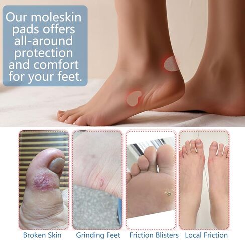 moleskin للأقدام - 2 "× 15 بوصة الشريط moleskin وسادة مرنة ، مثالية للركض ، المشي لمسافات طويلة ، والمشي - بسهولة إلى أي حجم - moleskin لون البشرة الداكنة للبثور (لفاتان) in Kuwait