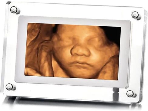 MBHB Digital Picture Frame, 7" Screen, Electronic Photo Frames for Ultrasound Replay, Re-chargeable 4GB Memory, USB Charging, Vertical/Horizontal Display, Upload Photos/Videos Easily in Saudi Arabia