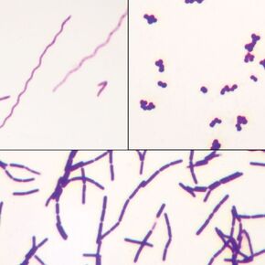 شريحة أنواع البكتيريا، مسحات منفصلة، ​​صبغة جرام in Kuwait