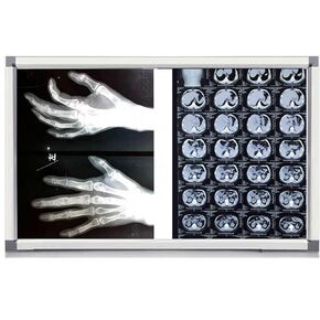 صندوق إضاءة LED بالأشعة السينية للعيادات الطبية والمستشفيات، سطوع قابل للتعديل، خالي من الوميض، إطار من الأكريليك والألومنيوم، 33 × 19 بوصة، موفر للطاقة، مثالي للأشعة السينية لتقويم العظام والأسنان in Kuwait