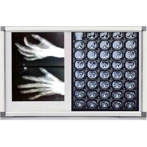 صندوق إضاءة LED بالأشعة السينية، سطوع قابل للتعديل، عارض خالٍ من الوميض للعيادات الطبية والمستشفيات، إطار متين من الأكريليك والألومنيوم، معدات مختبر مقاس 33 × 19 بوصة in Kuwait