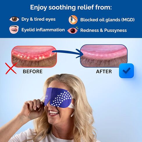 Rain Self Heating Steam Eye Mask for Dry Eyes - Warming Eye Compress with Moist Heat Therapy - Disposable Hot Compress Relief for Stye Treatment, Eye Fatigue & Dry Eye Relief (20 Masks) in Kuwait