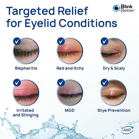BetterLids Boosted Hypochlorous Acid Eyelid Spray – Gentle Non-Sting Eyelid Cleanser Mist with Ectoin & Trehalose for Blepharitis, Dry and Itchy Lids – Daily Lid Hygiene Eye Spray, 50 ml in Kuwait