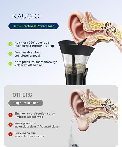منظف ​​شمع الأذن - مجموعة إزالة شمع الأذن بيد واحدة، نظام تنظيف يدوي لري الأذن، آمن ومريح وسهل الاستخدام، مجموعة إزالة شمع الأذن in Kuwait