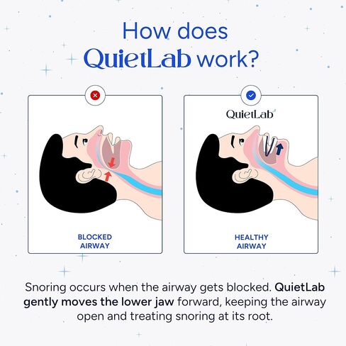 QuietLab Pro Anti-Snoring Mouthpiece - Adjustable Snoring Mouth Guard, Orthodontist Designed, No Boiling Required - BPA-Free Medical Grade - Designed for Nighttime Snoring Control in Kuwait