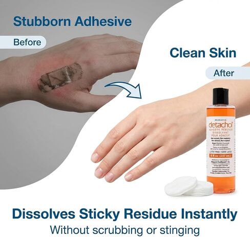 مزيل لاصق - زجاجة 8 أوقية لإزالة آمنة وسهلة للمواد اللاصقة الطبية والضمادات وشريط الجلد - خالي من الكحول والأسيتون - لطيف على البشرة الحساسة in Kuwait